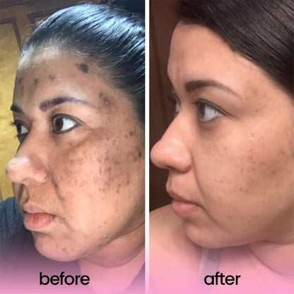 Alterity Turmeric & Kojic Acid Cleansing Pad