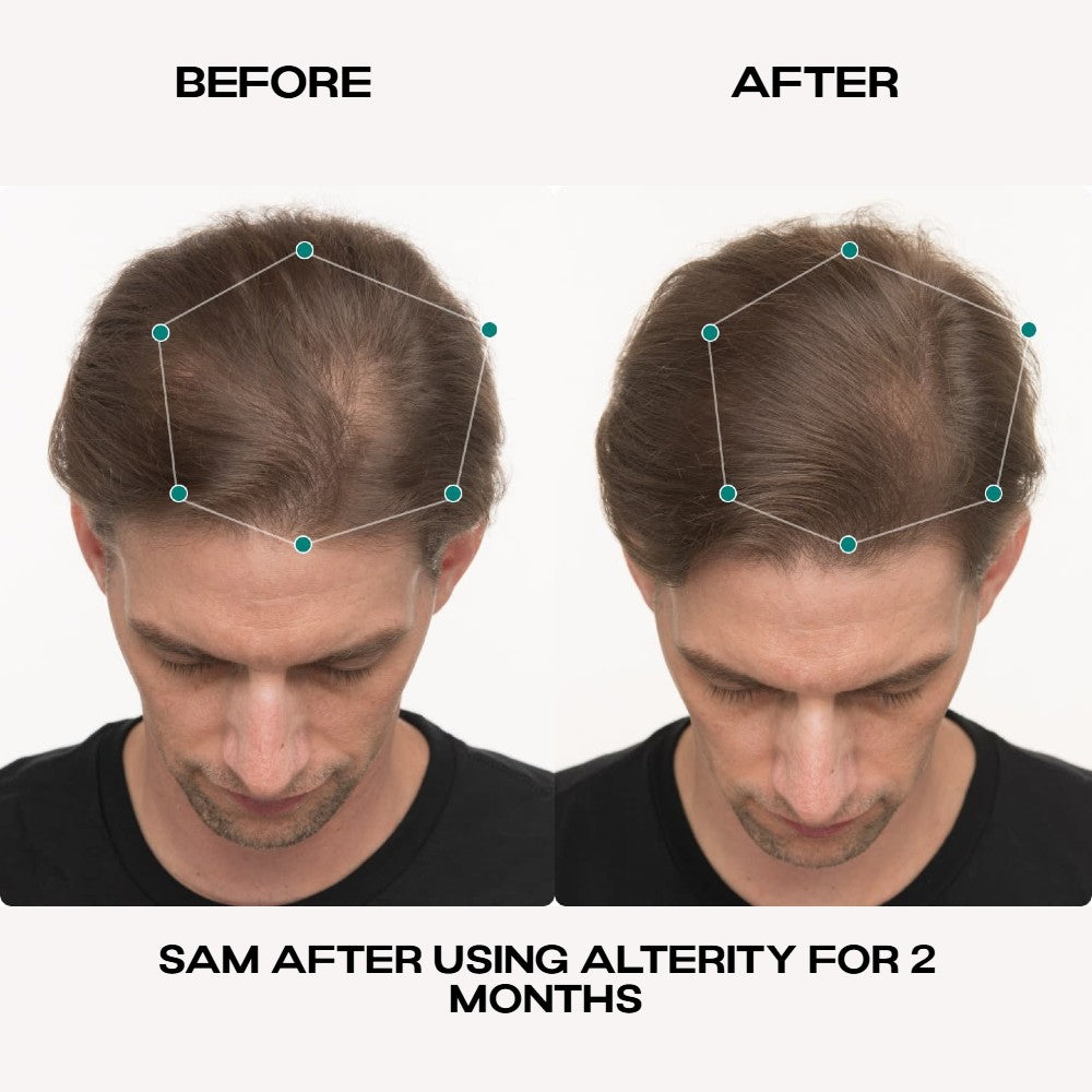 Hair Growth Serum
