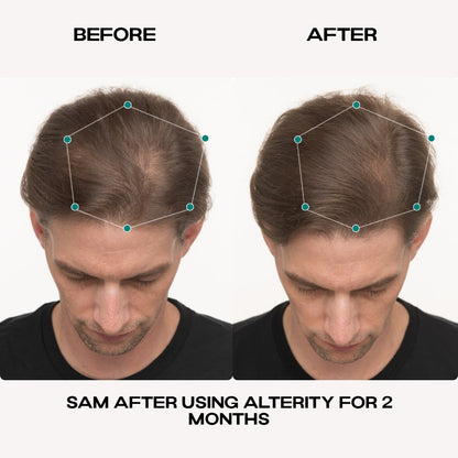 Hair Growth Serum