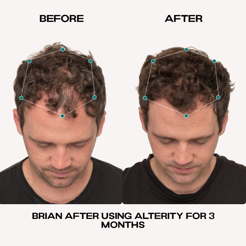 Hair Growth Serum