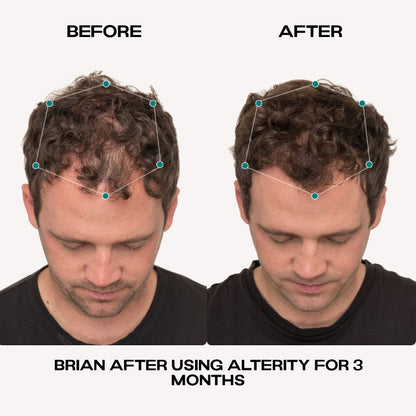 Hair Growth Serum