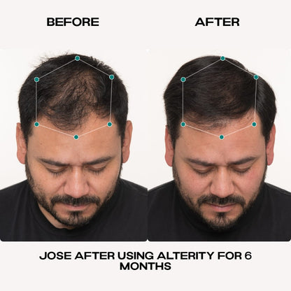 Hair Growth Serum